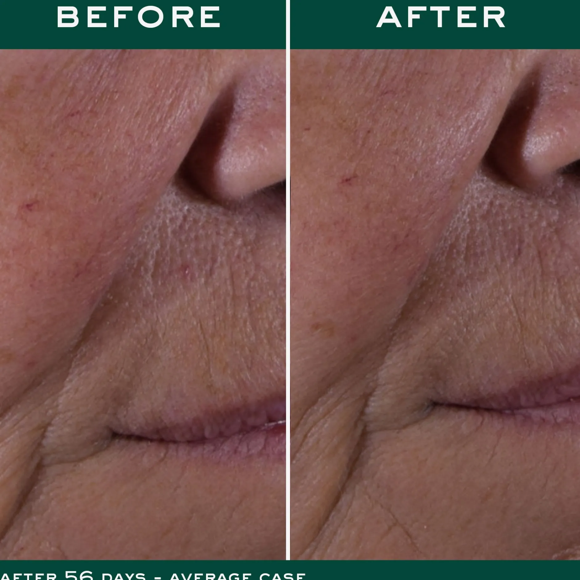 die_globale_antiagingcreme_4.webp NUXE Tagescreme | Anti-Aging*Die Globale Anti-Aging-Creme